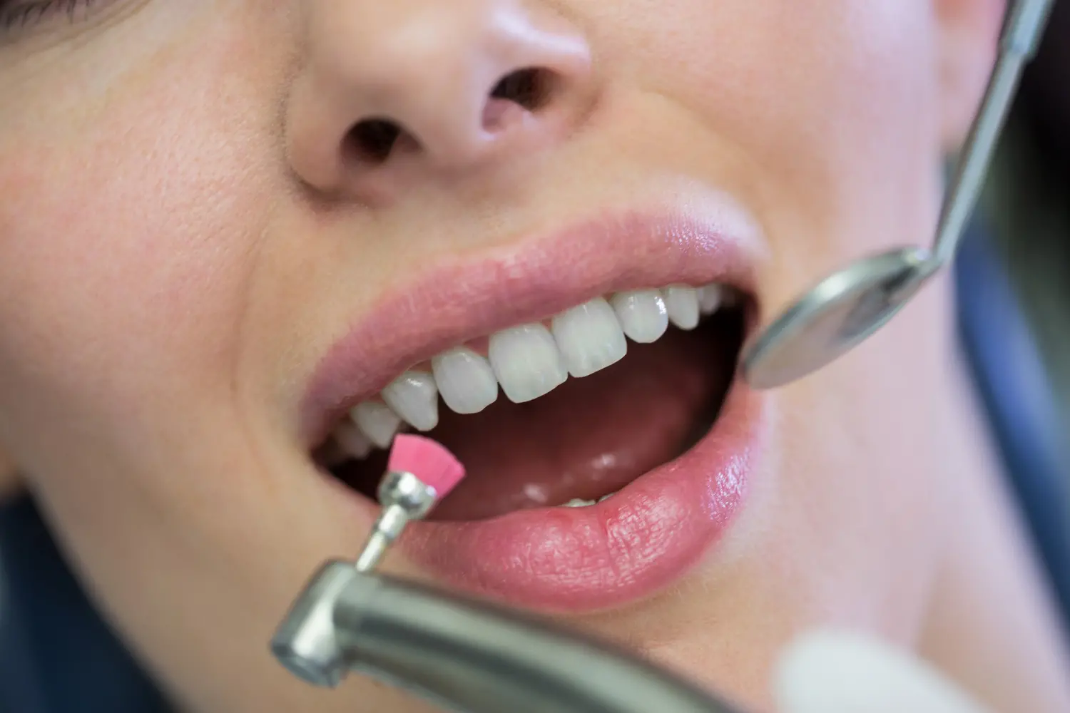 02-periodoncia-1