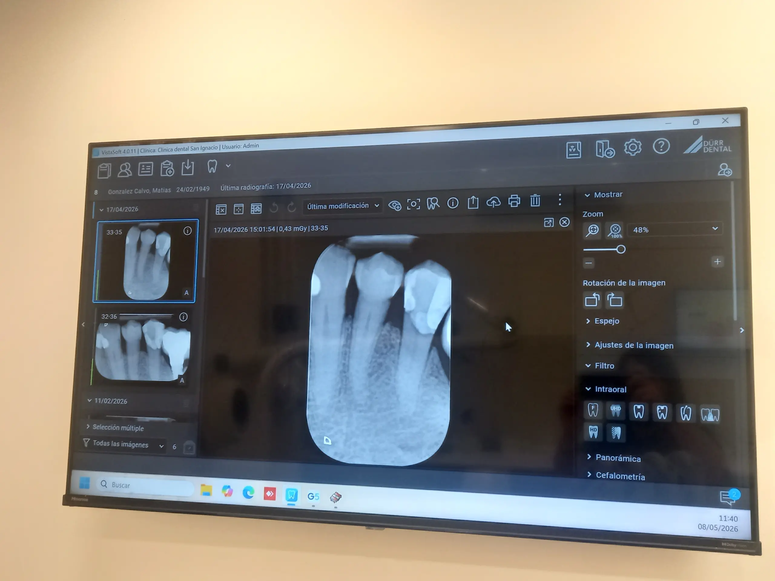 02-rx-digital-intraoral